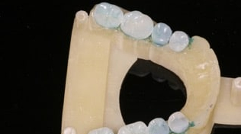 Typodont Model occlusal table